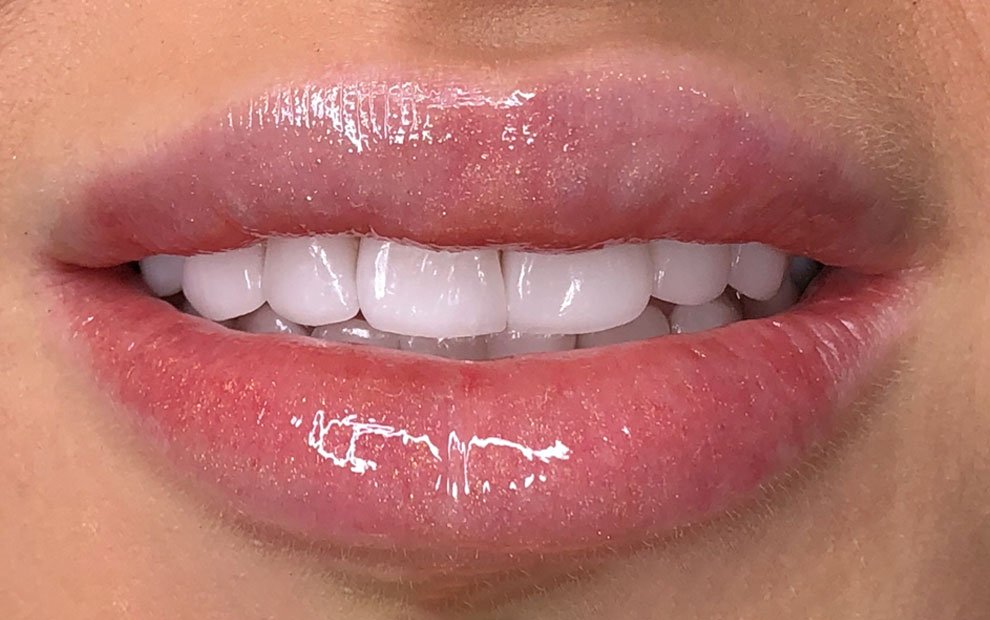 Клиника стоматологии и косметологии Smile studio на метро Дубровка