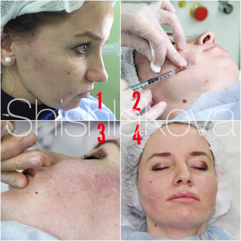 Клиника эстетической медицины Shishlakovi clinic на Котельнической набережной