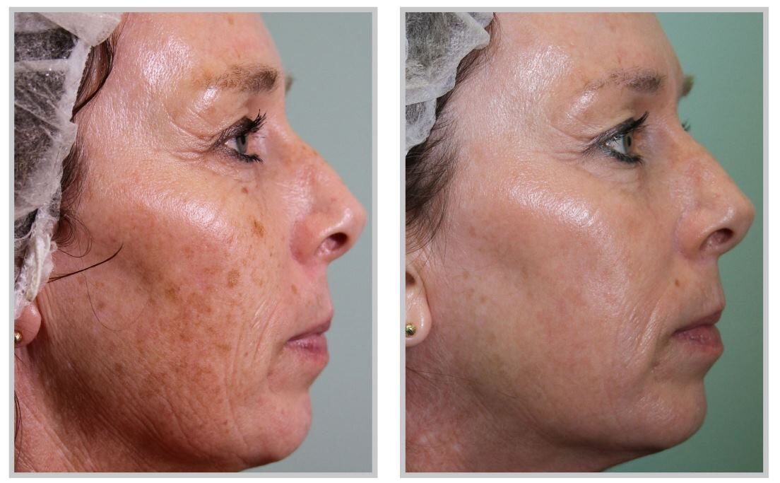 Институт красоты Le Colon на метро Университет